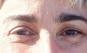 Semillas radioactivas, temblor esencial