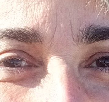 Semillas radioactivas, temblor esencial