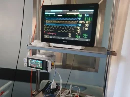 El Hospital de Antequera incorpora un nuevo sistema de monitorizacion para pacientes críticos